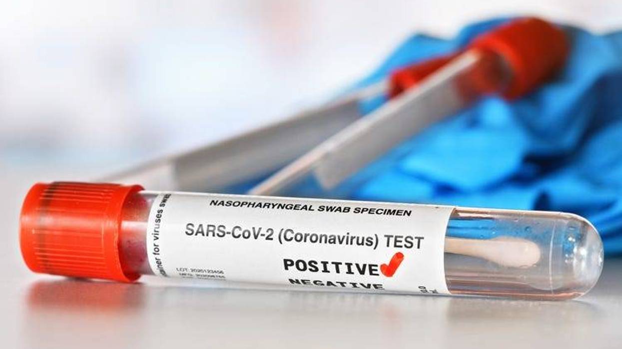 Coronavirus Test