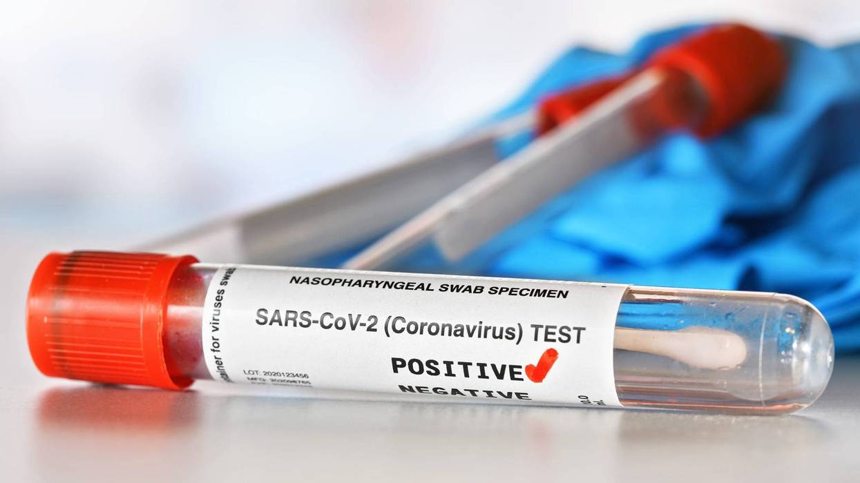 Coronavirus Test