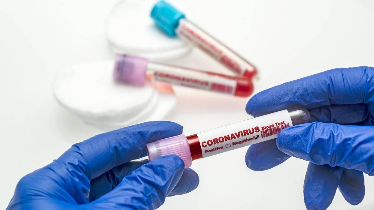 Coronavirus Test