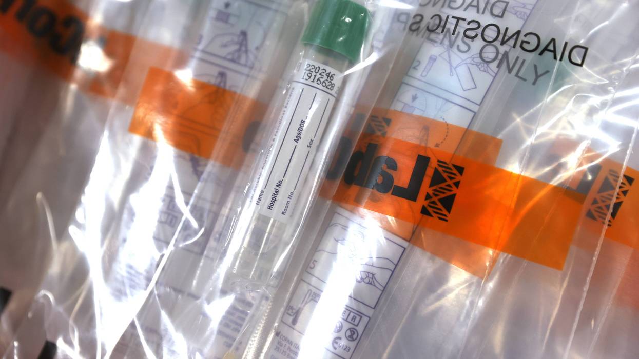 Coronavirus testing kits