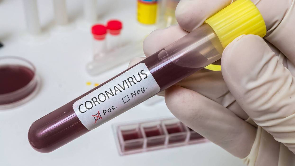 Coronavirus