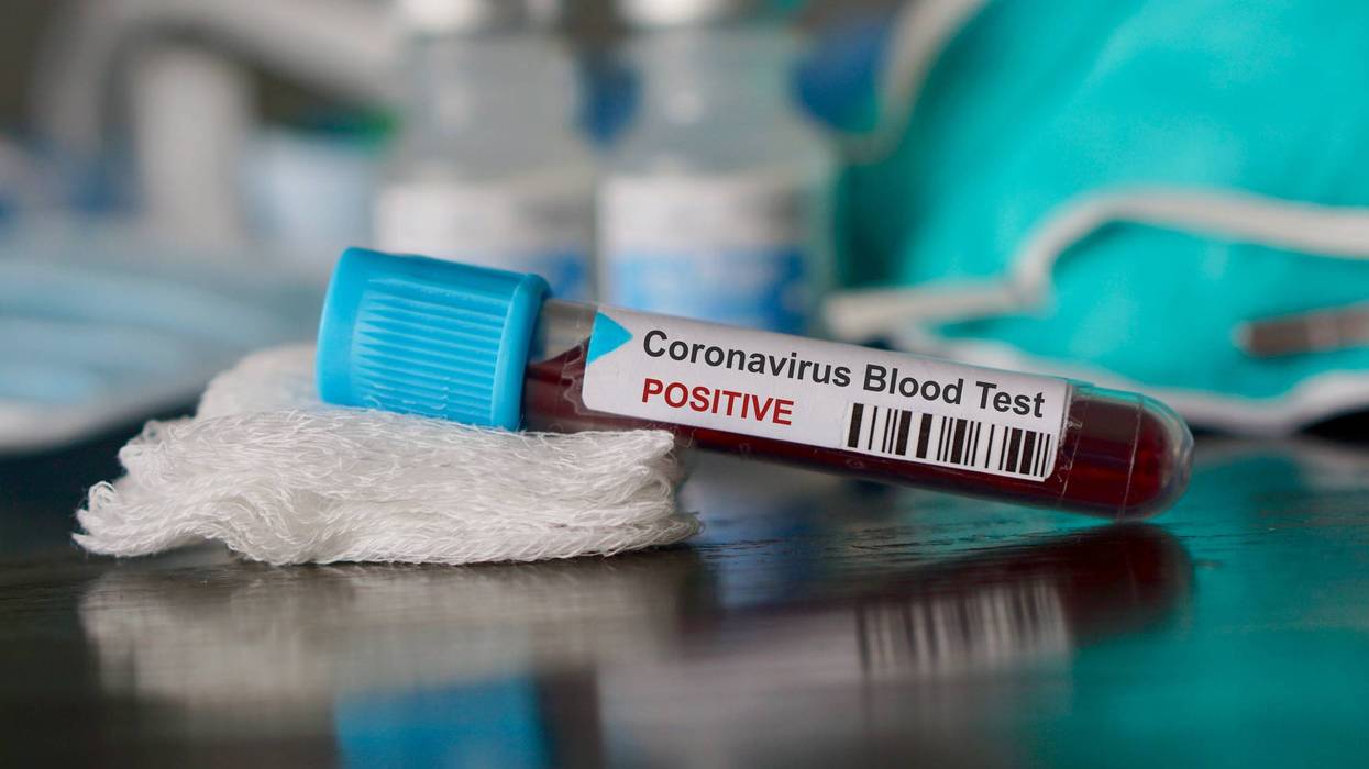 Coronavirus