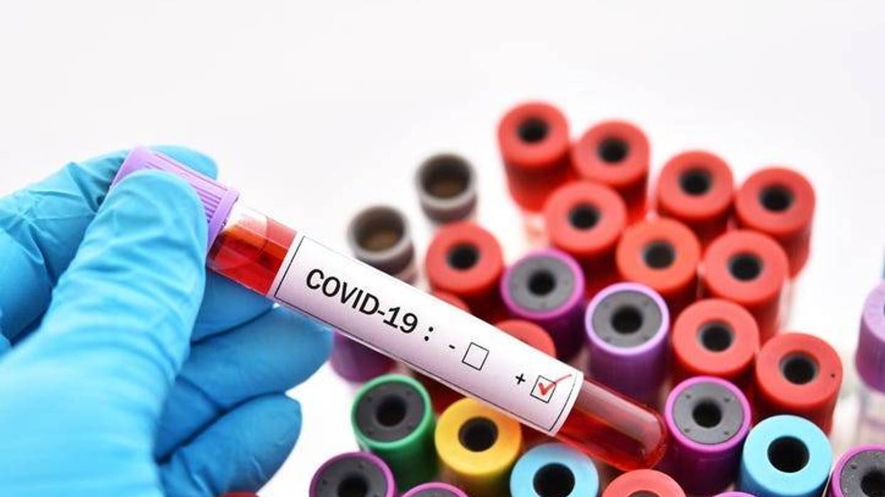 Coronavirus