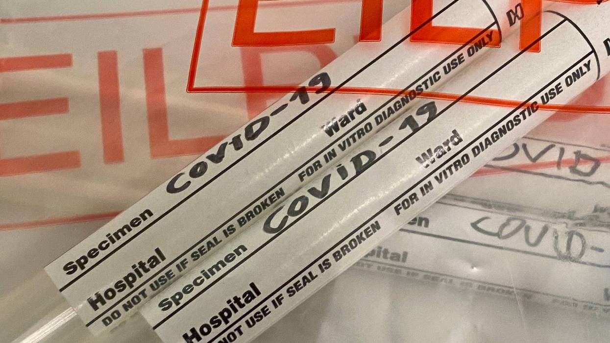 coronavirus