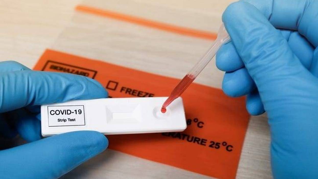 Covid-19 Anti-Body tests