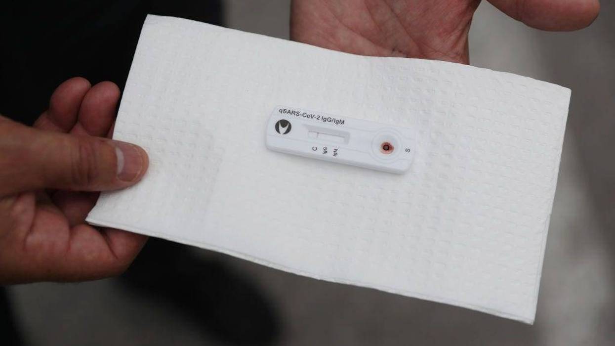 Covid-19 Antibody Results