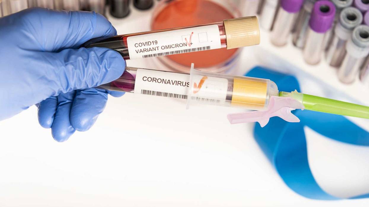 COVID-19 blood samples stock photo.