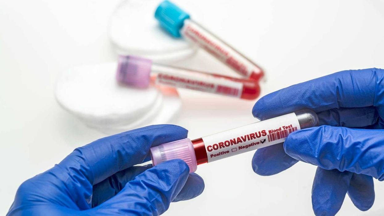 Covid-19 coronavirus test stock photo