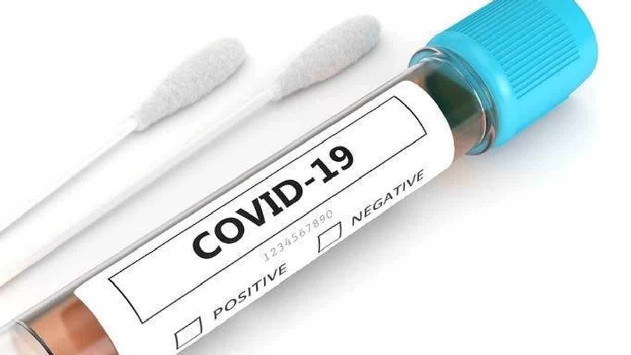 covid-19 nasal swab laboratory test