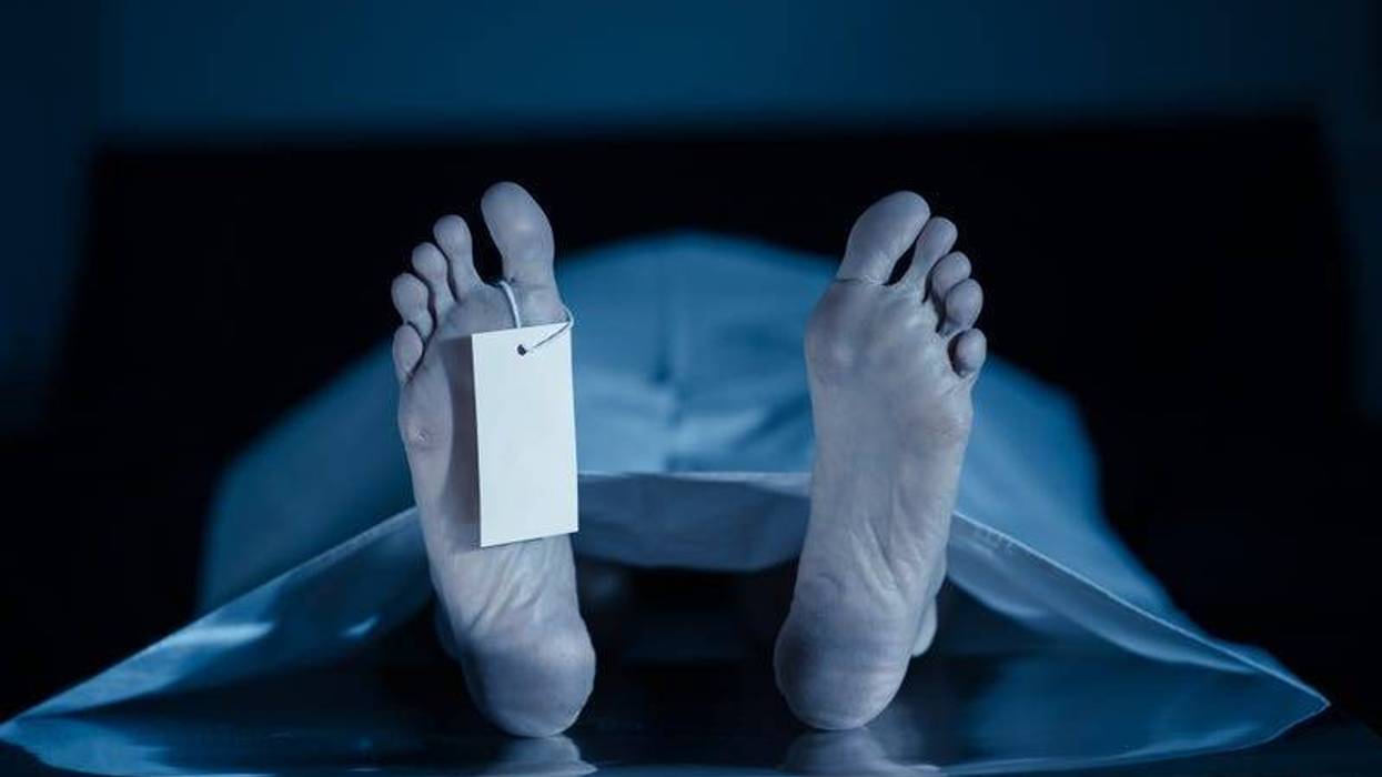 Dead body