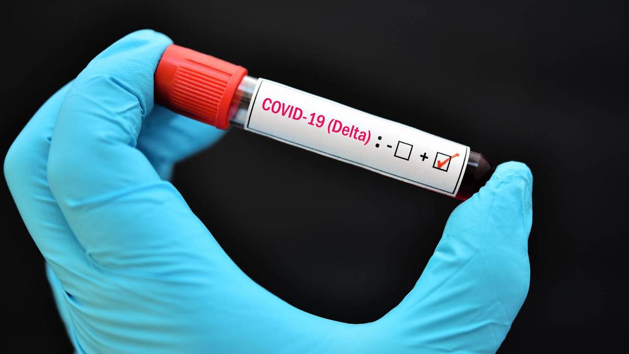 Delta variant COVID-19 positive, blood sample tube positive with Delta variant of COVID-19