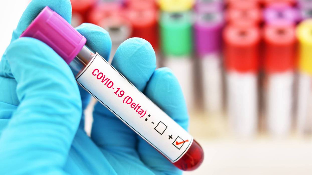 Delta variant COVID-19 positive, blood sample tube positive with delta variant or Indian strain COVID-19
