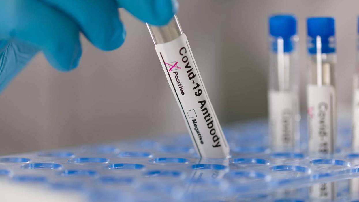 Dillons announces coronavirus rapid antibody testing at all pharmacy locations