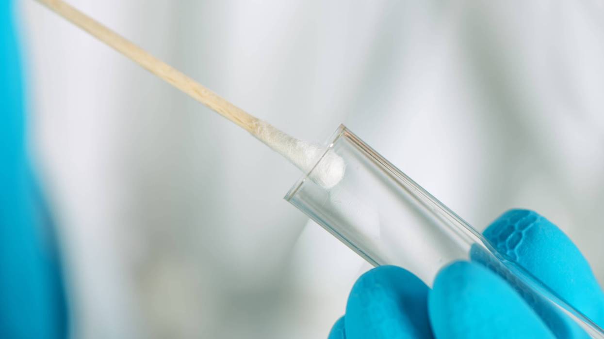 DNA sample collection