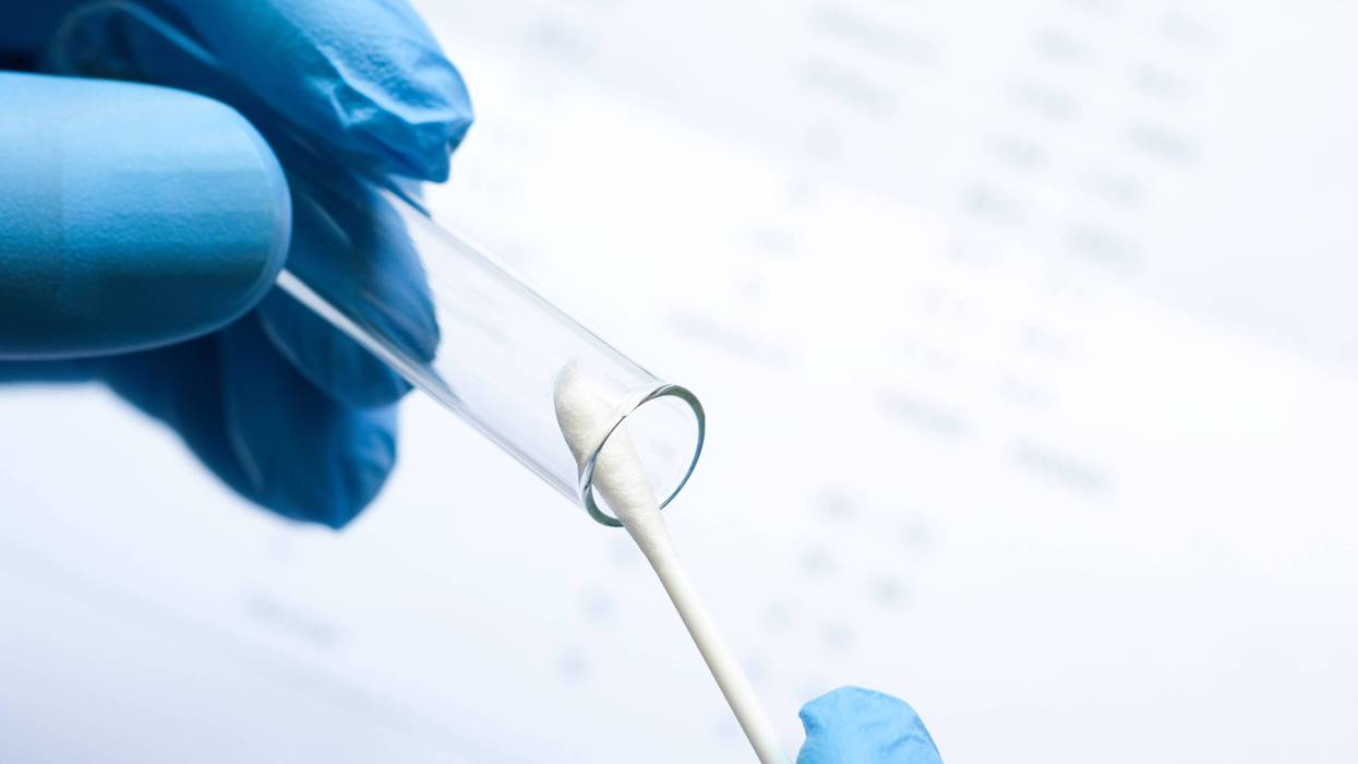 DNA Testing