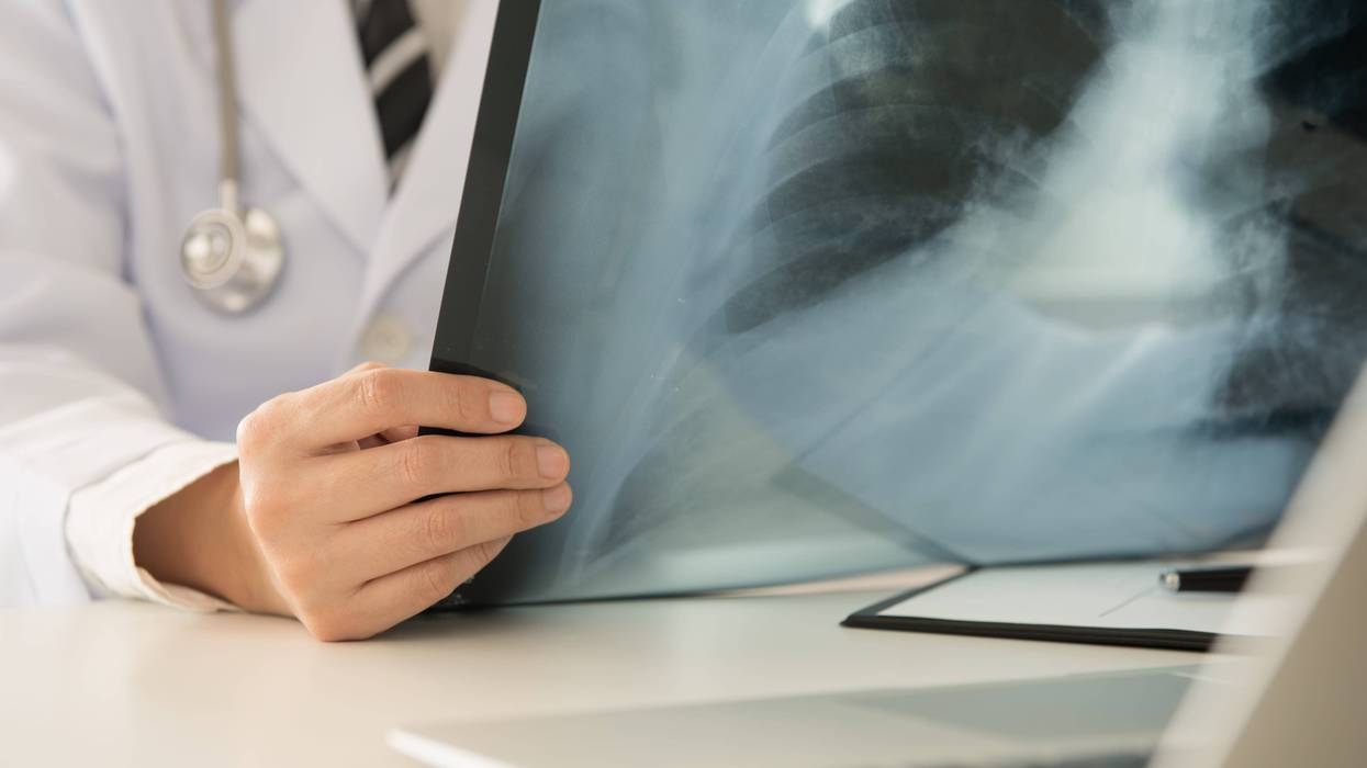 Doctor examining lung x-rays