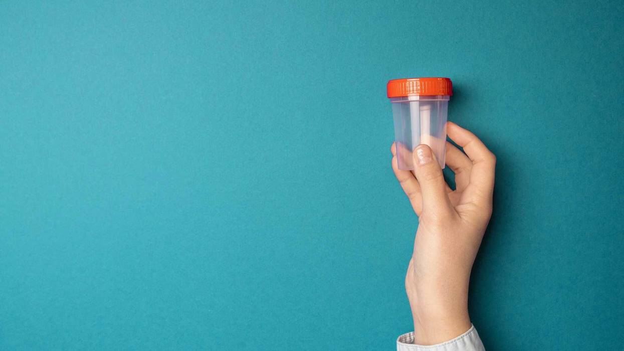 Doctor holding a cup for urine for drug testing.