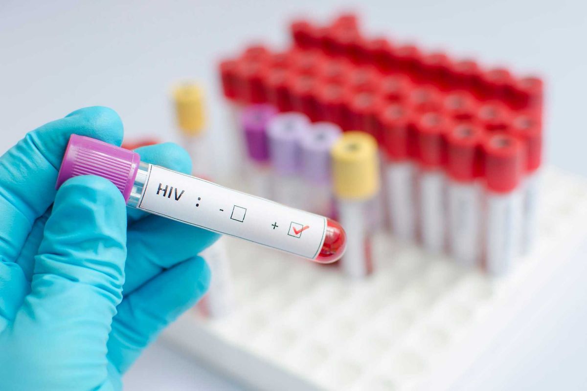 Doctor holding an HIV test.