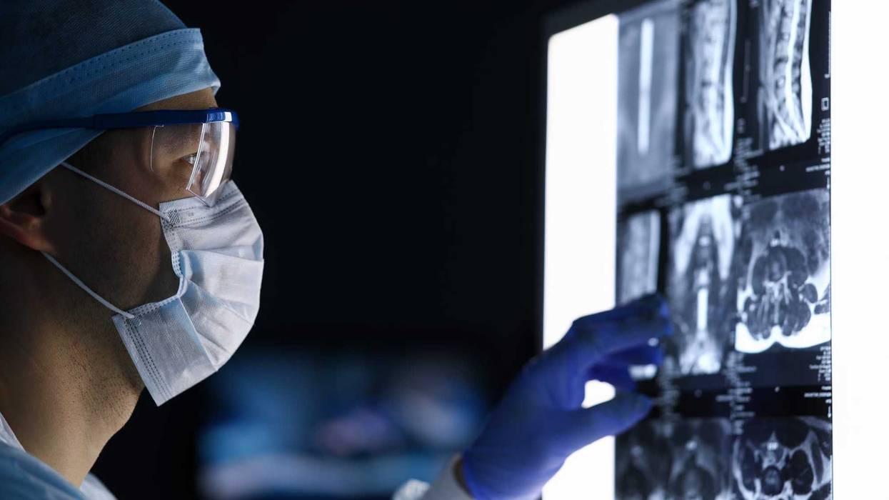 Doctor looking at scans before surgery.