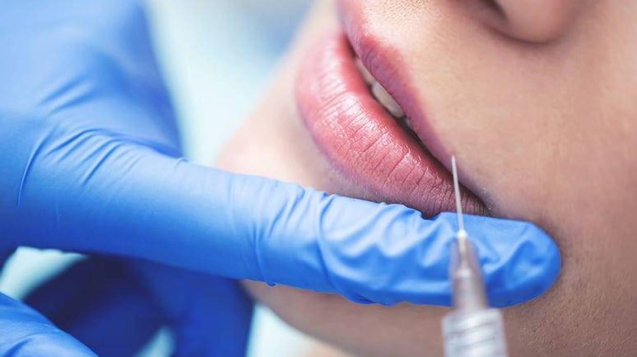 Doctor making injection in woman's lips