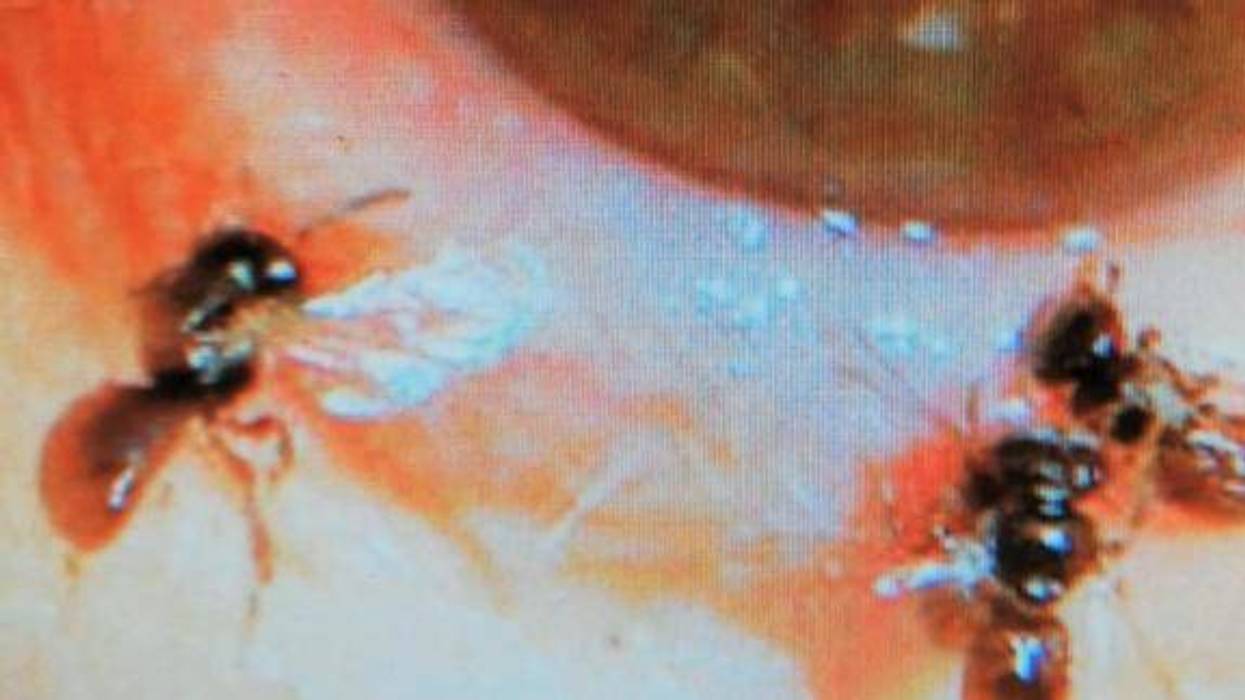 Doctors shared these images of the four tiny sweat bees they found in a woman's eye.