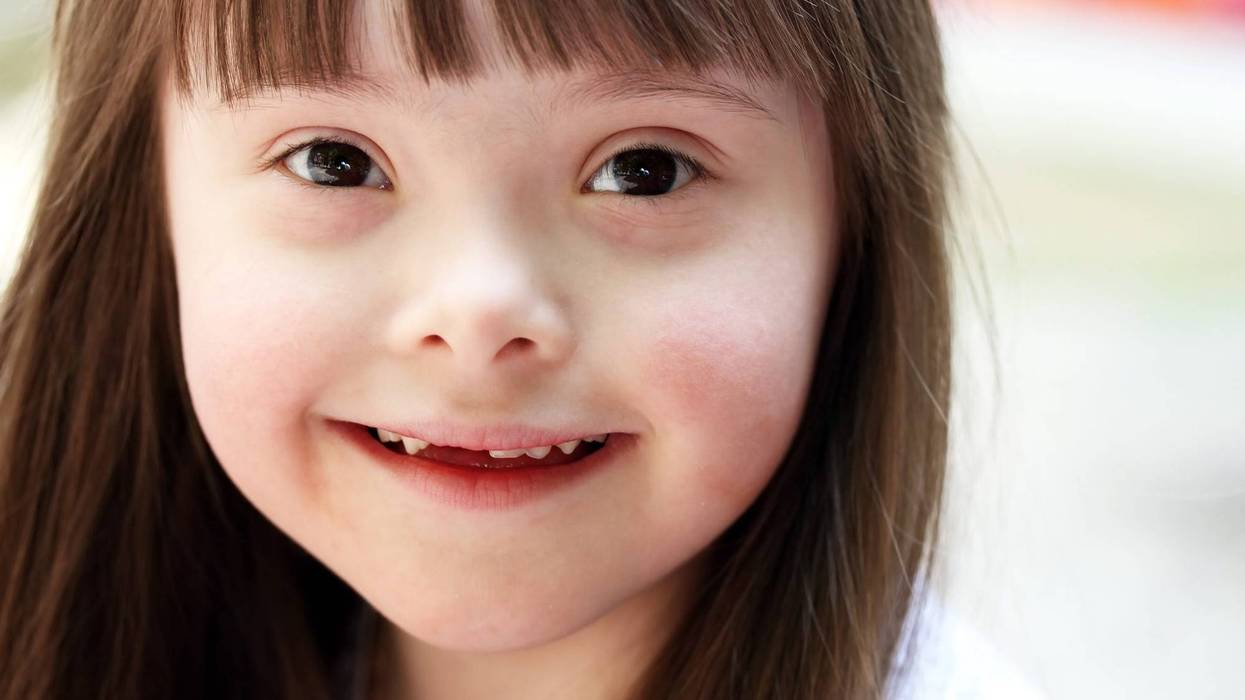 Down syndrome child