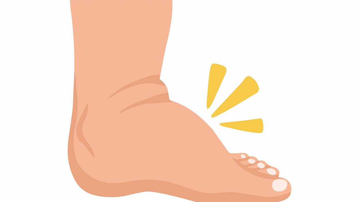 Edema or Swollen Foot Disease Hand Drawn