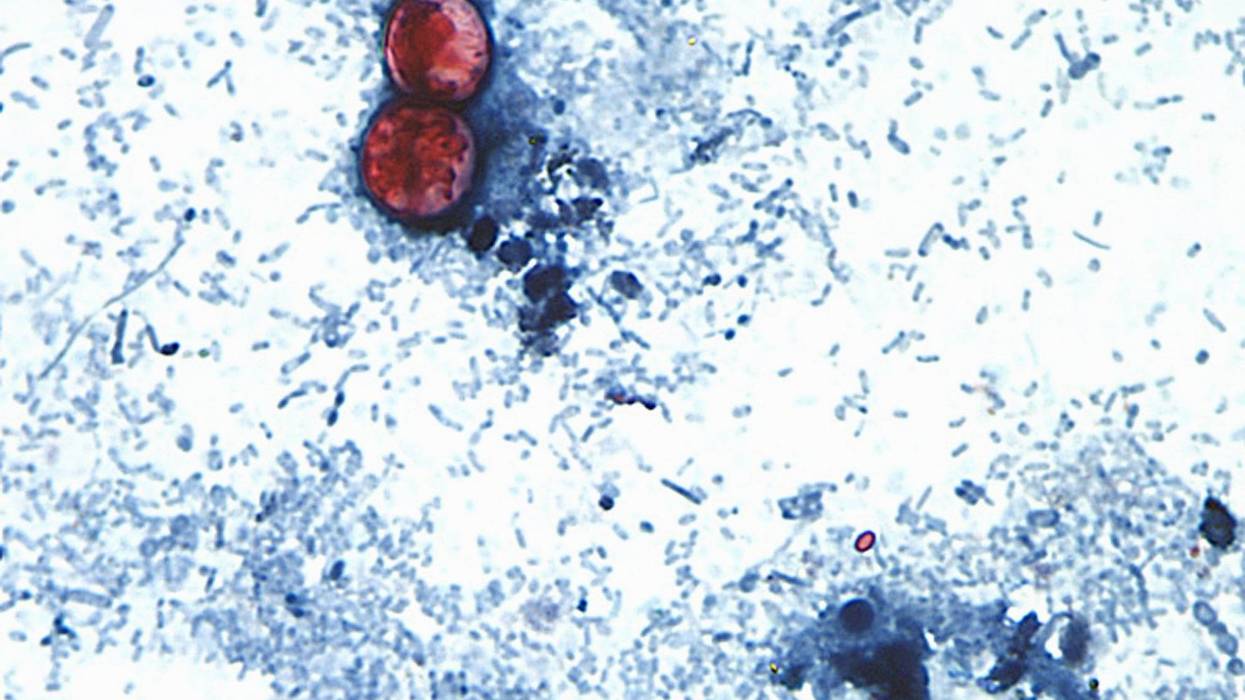 EEUU-CYCLOSPORA