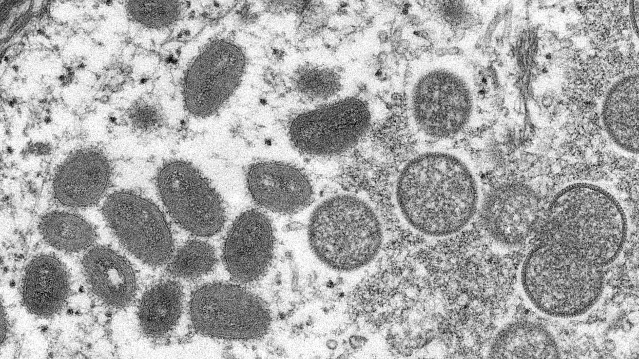 Electron microscope image of various virions (virus particles) of the monkeypox virus taken from human skin, 2003.