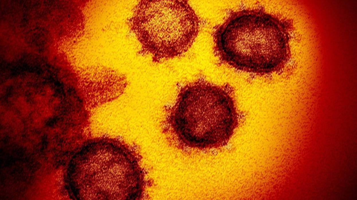 Electron microscope image the new coronavirus, SARS-CoV-2 (February 2020)
