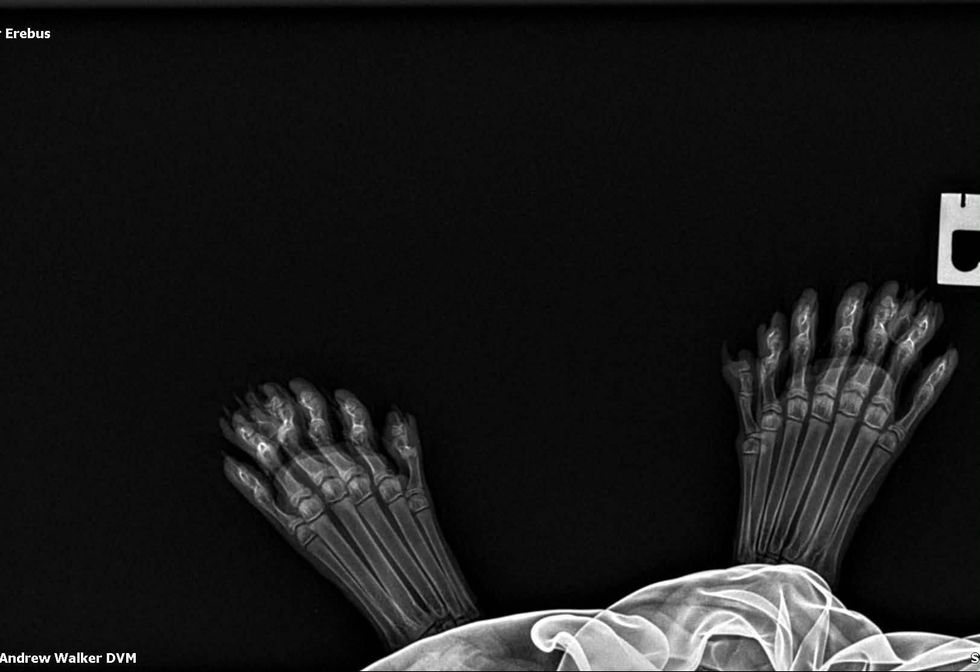 Erebus Anomaly's toe X-ray.
