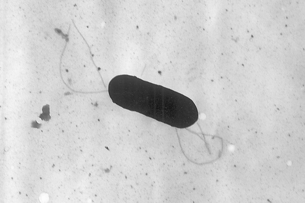 FILE - This 2002 electron microscope image made available by the Centers for Disease Control and Prevention shows a Listeria monocytogenes bacterium