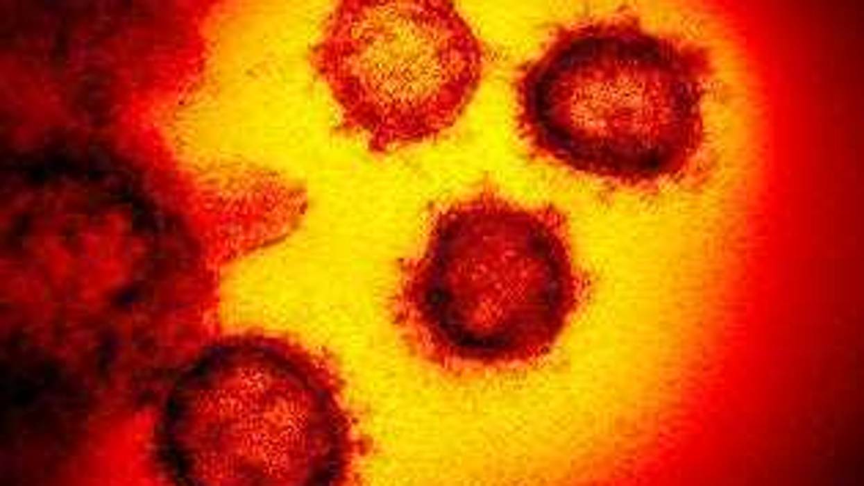 FILE - This undated electron microscope image made available by the U.S. National Institutes of Health in February 2020 shows the Novel Coronavirus SARS-CoV-2. (NIAID-RML via AP)