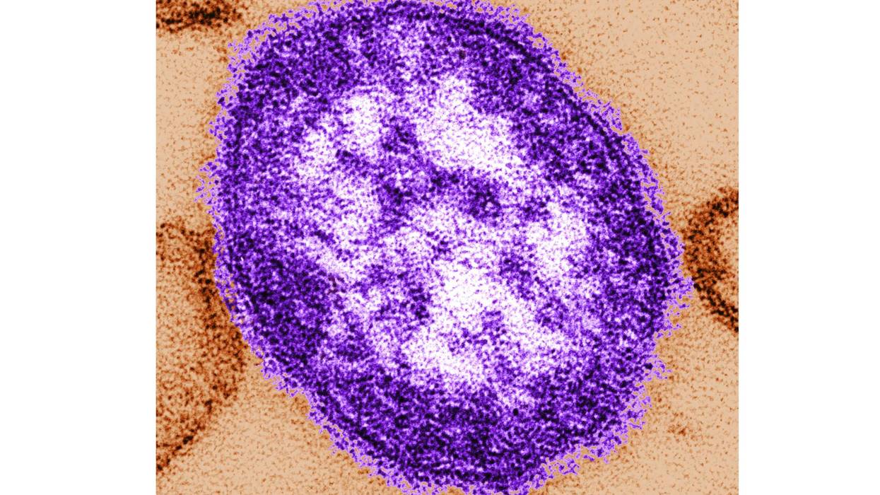 Pennsylvania officials report state's 3rd death involving measles