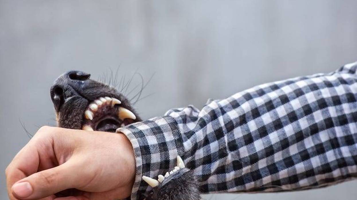 German shepherd bites a man