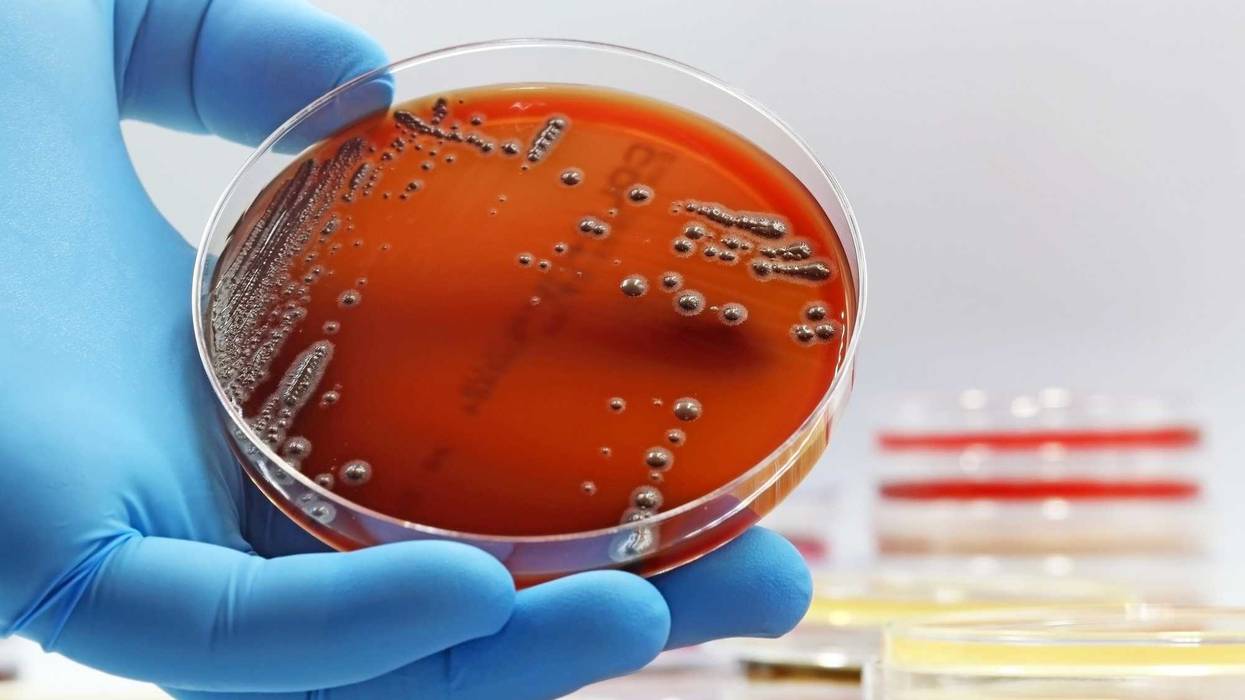 gloved hand with Petri dish