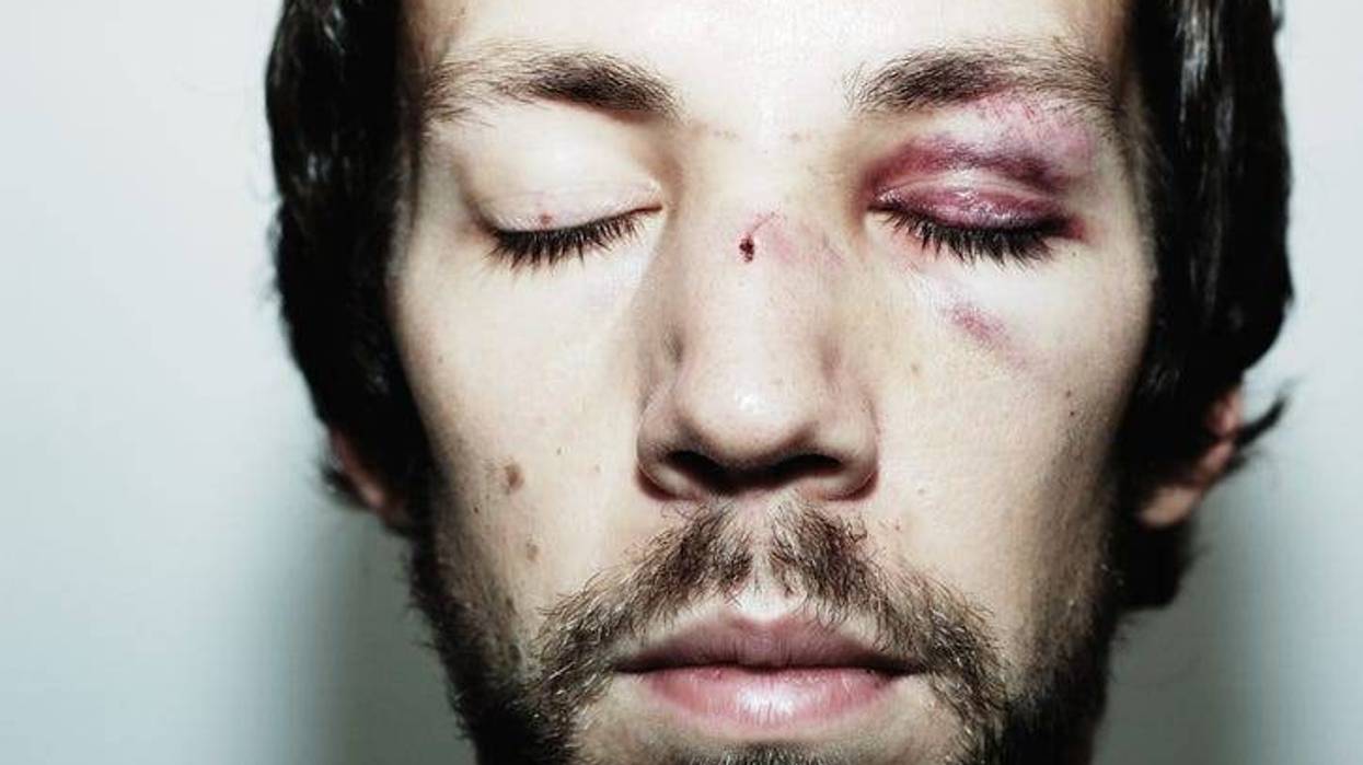golpeado