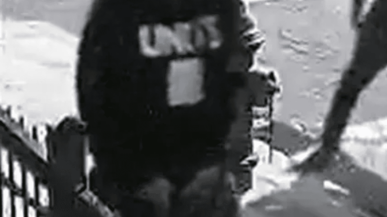 Gunman pistol-whips, shoots boy, 15, in groin on Bronx street