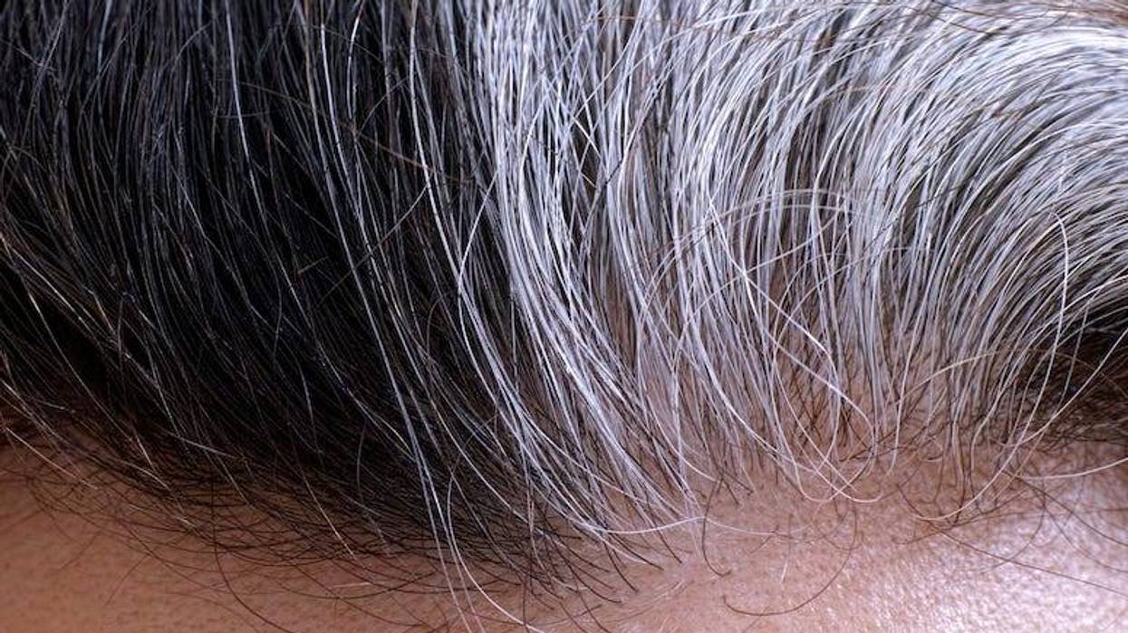Hair going gray