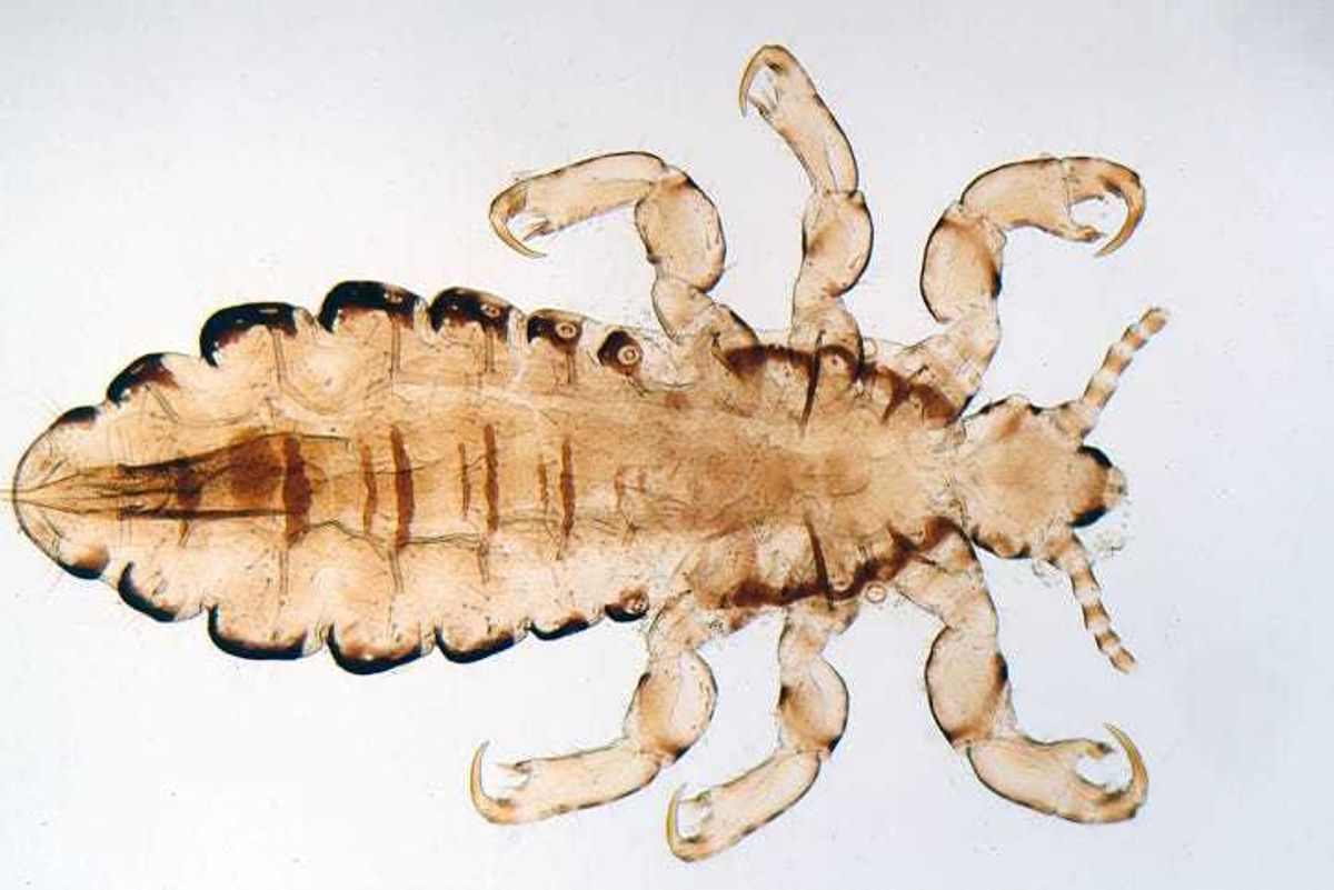 HEAD LICE