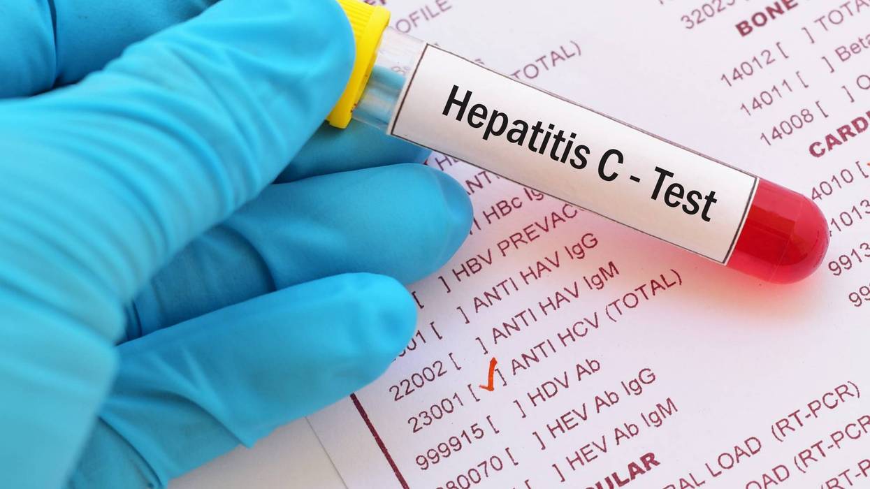 Hep C test