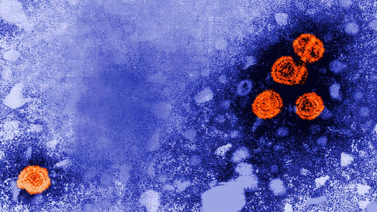 Hepatitis B
