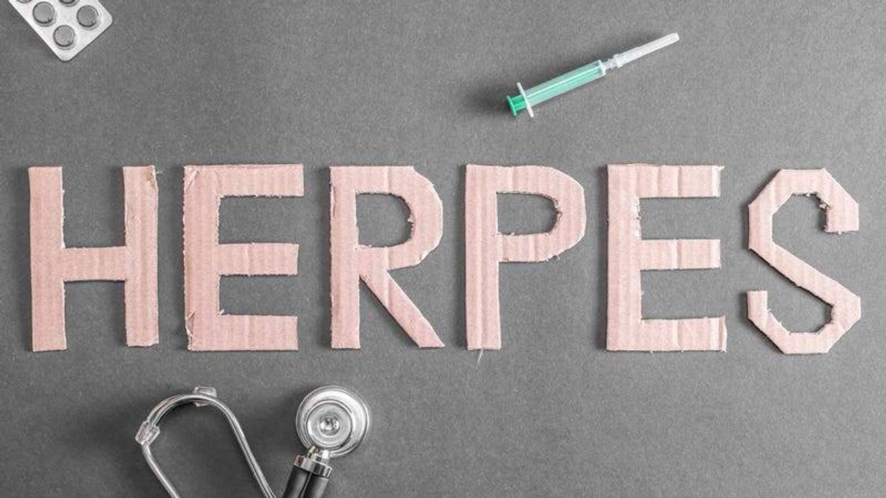 herpes