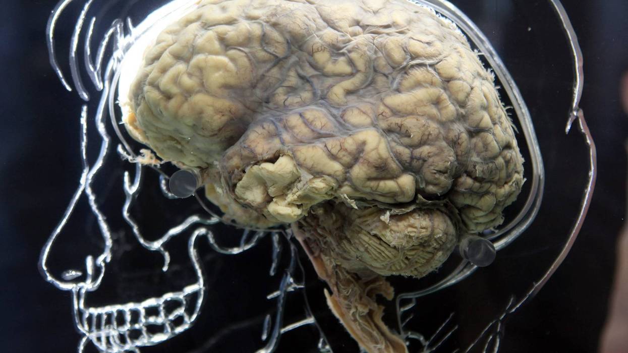 human brain
