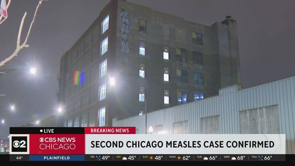 2nd measles case reported in Chicago