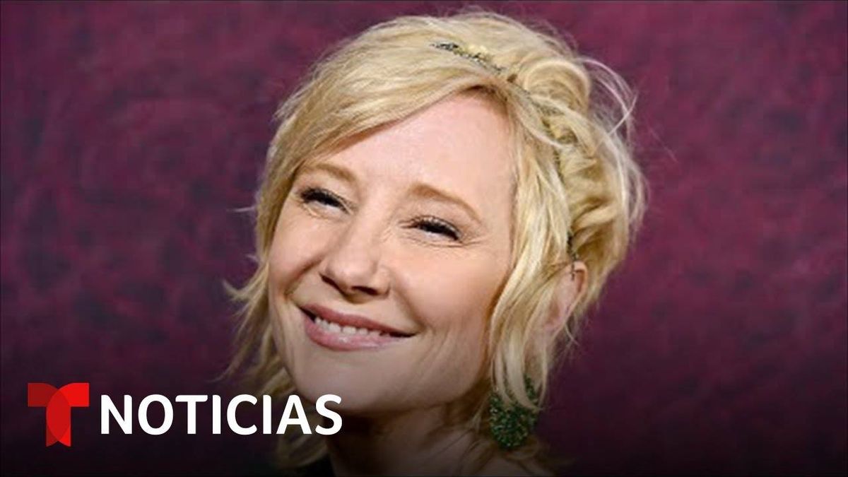 La Actriz Anne Heche En Coma Despues De Grave Accidente En Los Angeles