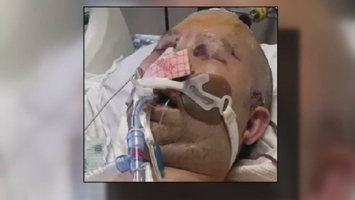 Money being raised for longtime Evergreen Park chef who remains in a coma after being carjacked