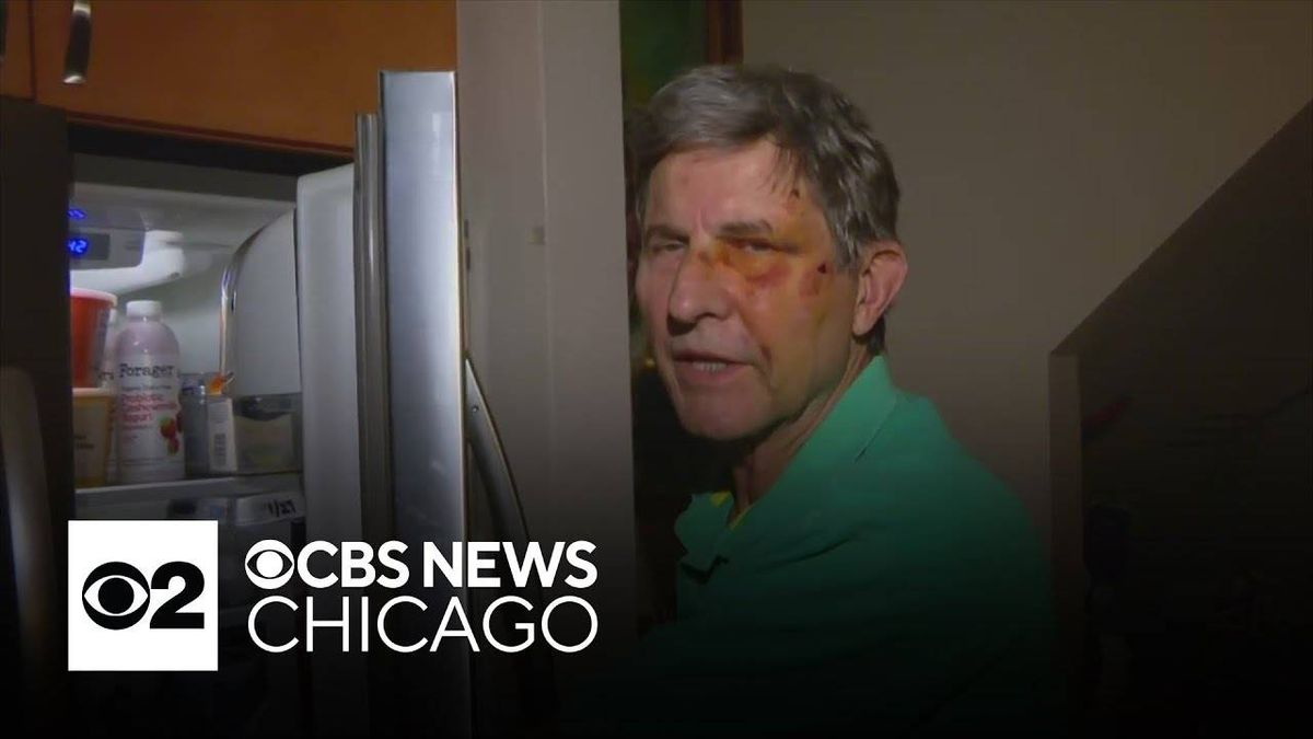 Elderly Irving Park couple attacked in broad daylight