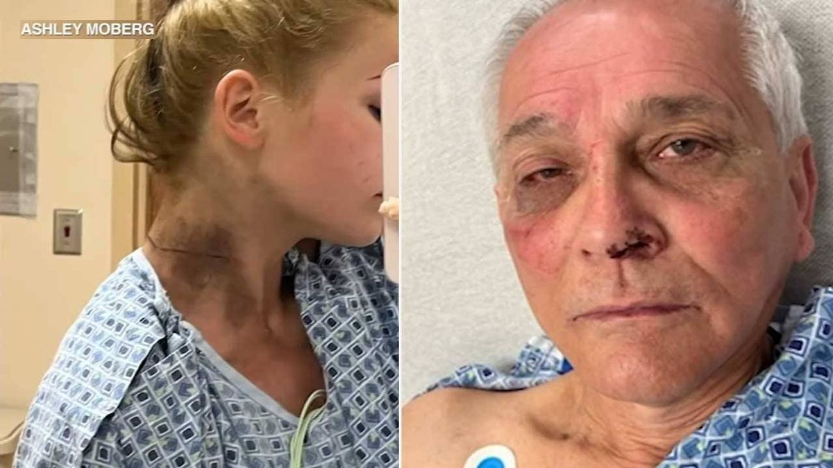 'We're very lucky': Father, daughter survive lightning strike after Yankees game in Tampa: reports