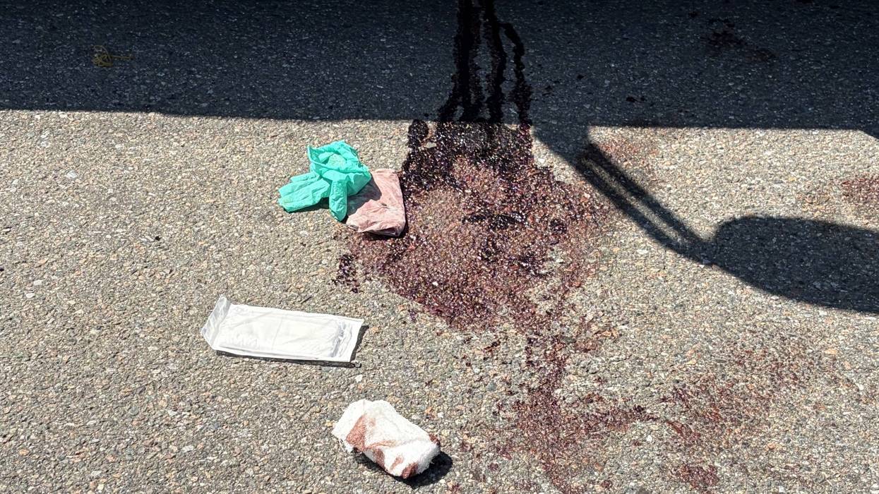 Man stabbed with meat cleaver during road rage attack in Queens